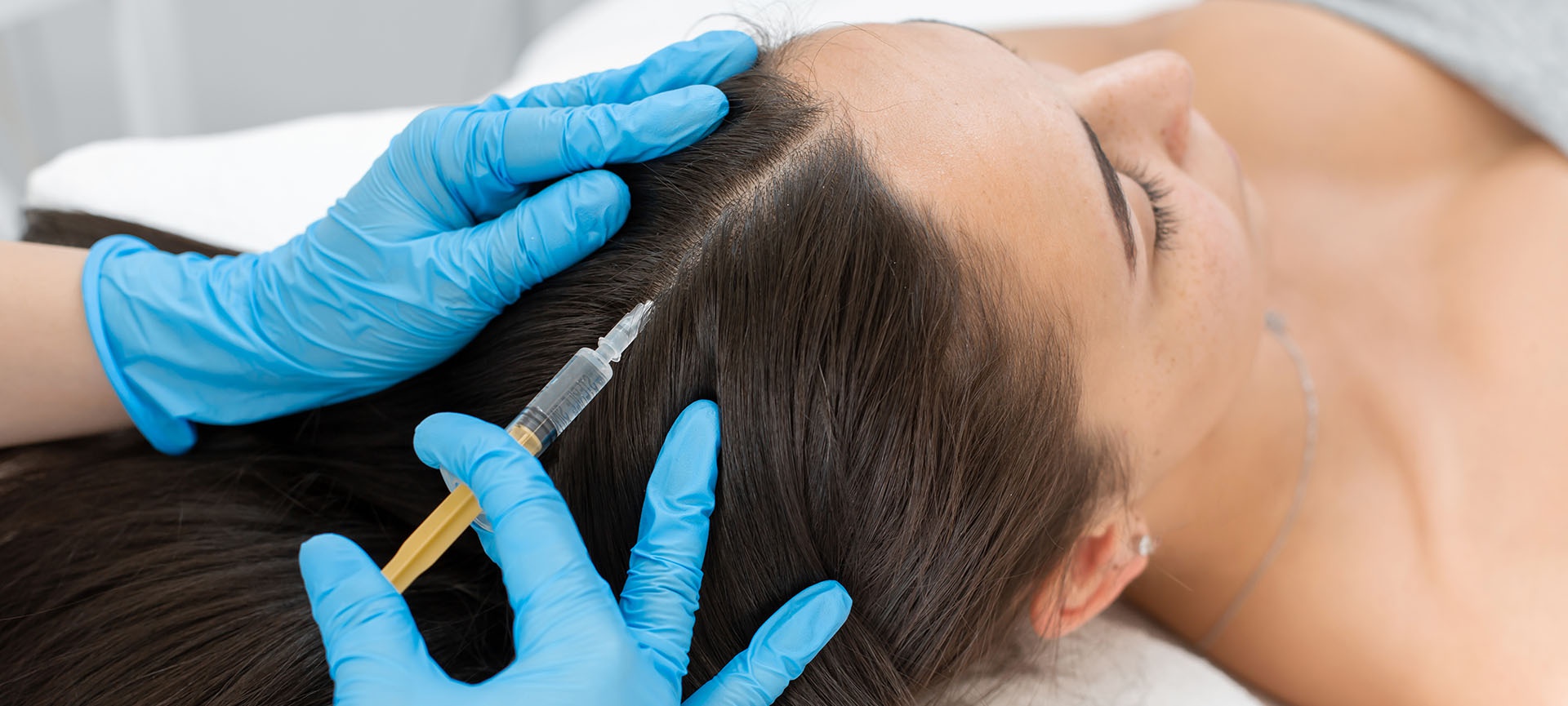 PRP Hair Treatments – What is it & Why You Should Consider It?