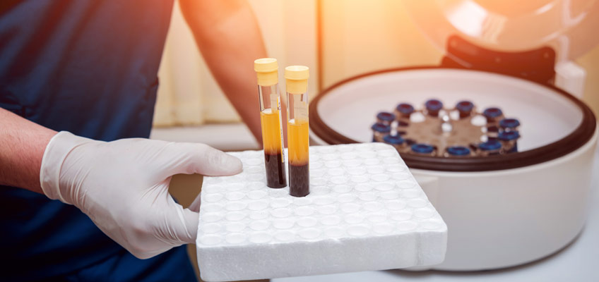 Platelet-Rich Plasma: Is it Right for Me?