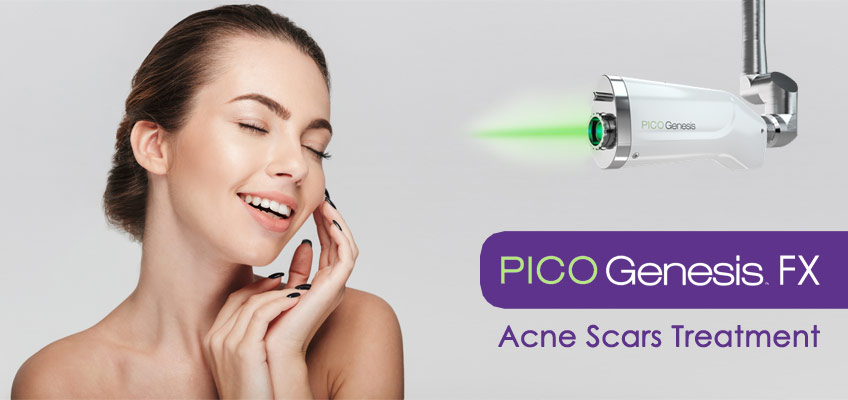 Treating Acne Scars With Pico Gensis Fx