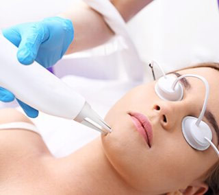 MesoTherapy Treatment