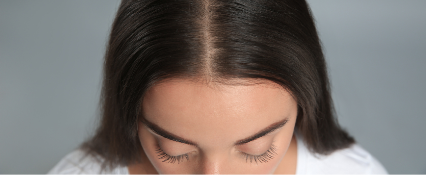 4 Sure Ways to Know You’re An Ideal Candidate for PRP Hair Therapy