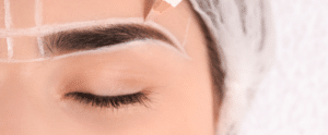 Microblading Laser Removal (1)