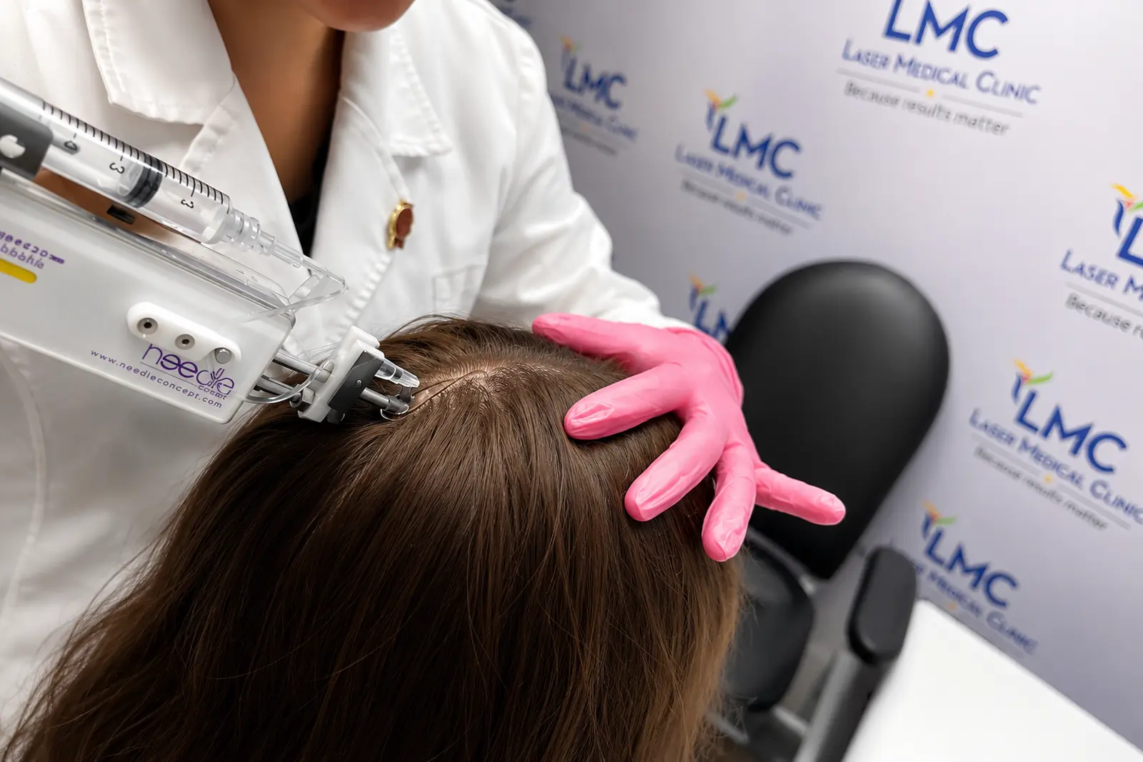 Hair mesotherapy scalp injections for thinning hair