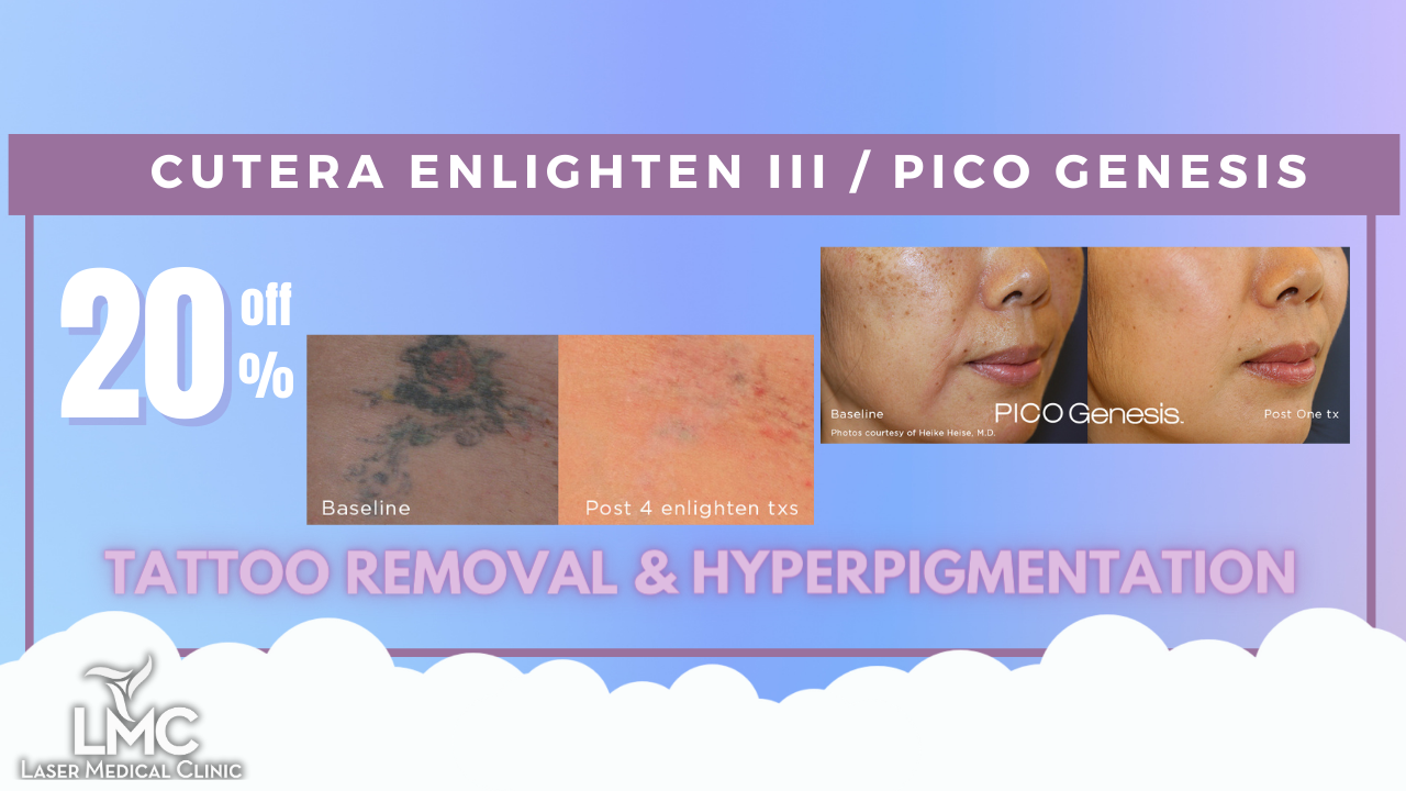 Laser Tattoo Removal Perth | Proven and Tested-Quality Equipment