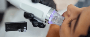Rf Microneedling Benev Exosomes