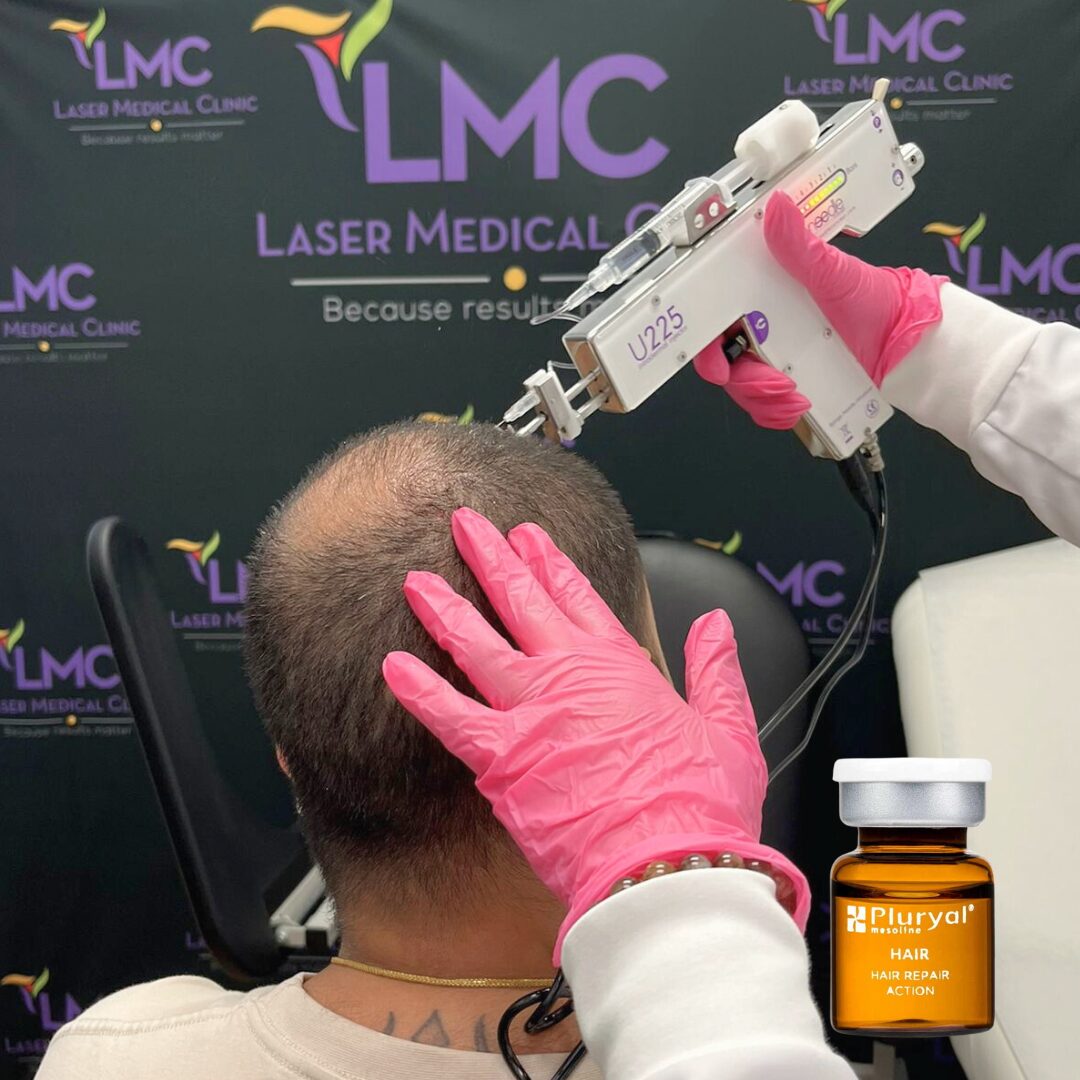 Scalp Mesotherapy with Mesoline treatment