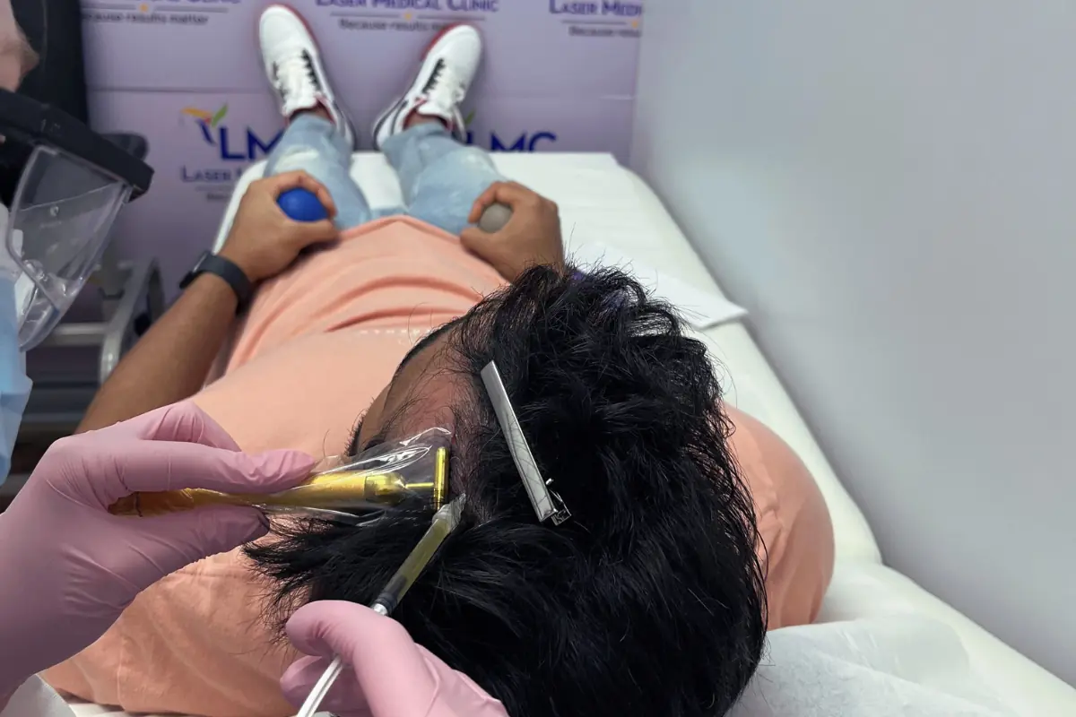 Arthrex ACP PRF for Hair Restoration