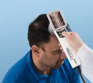 AI-Driven HairMetrix