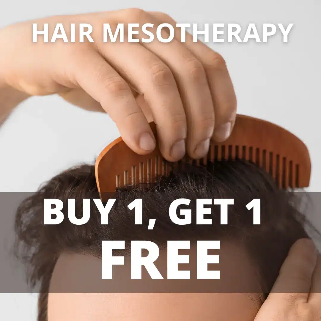 Hair Mesotherapy BOGO Offer
