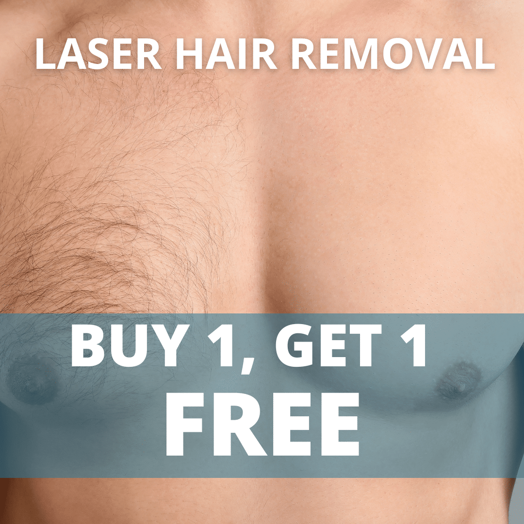 Laser Hair Removal BOGO Offer