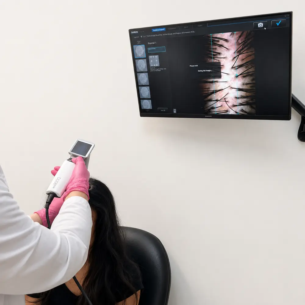 HairMetrix scalp imaging used during a personalized hair-loss assessment at LMC