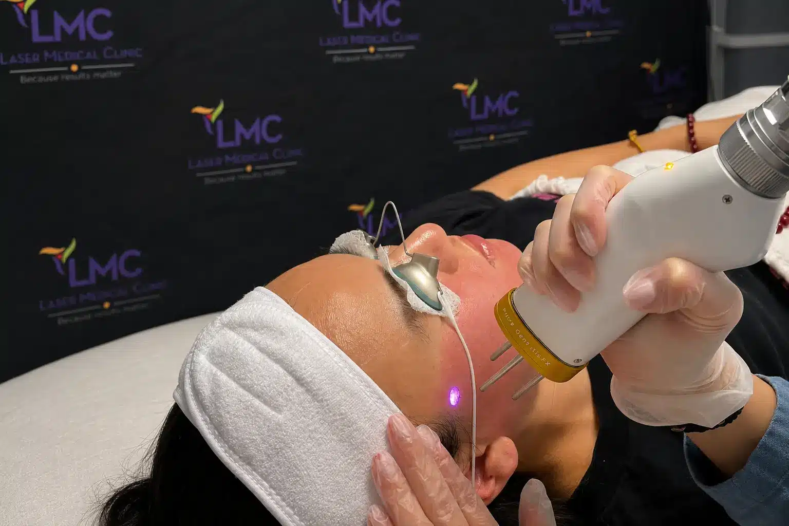 Cutera PICO Genesis FX fractional laser for acne scars and skin resurfacing in Richmond Hill