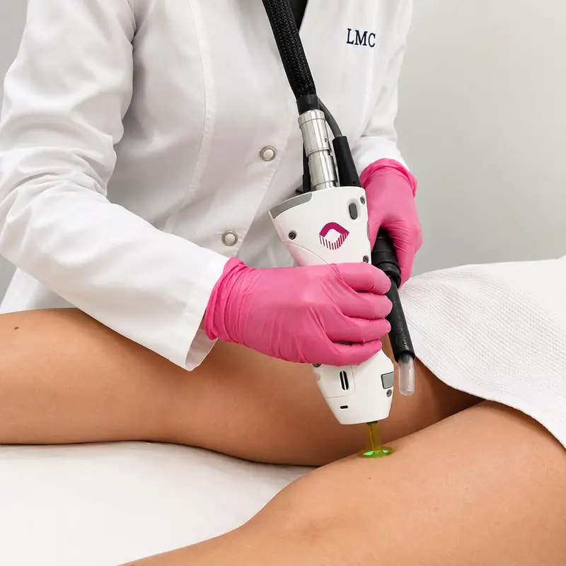 Candela GentleMax Pro Plus laser hair removal treatment at LMC in Richmond Hill